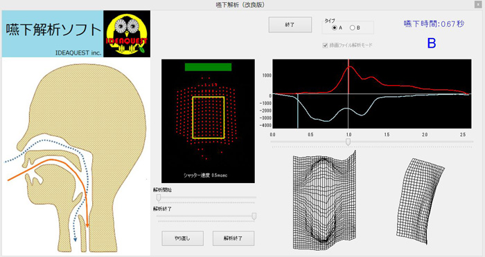 Swallowing function analysis and diagnostic systems without x-ray exposure