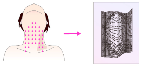 Figure 5 Acquisition of 3 dimensional image from the light spots on throat
