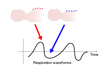 Figure 4 Acquisition of respiration waveforms