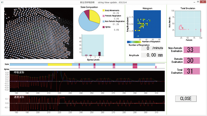 Infant respiratory function analysis systems